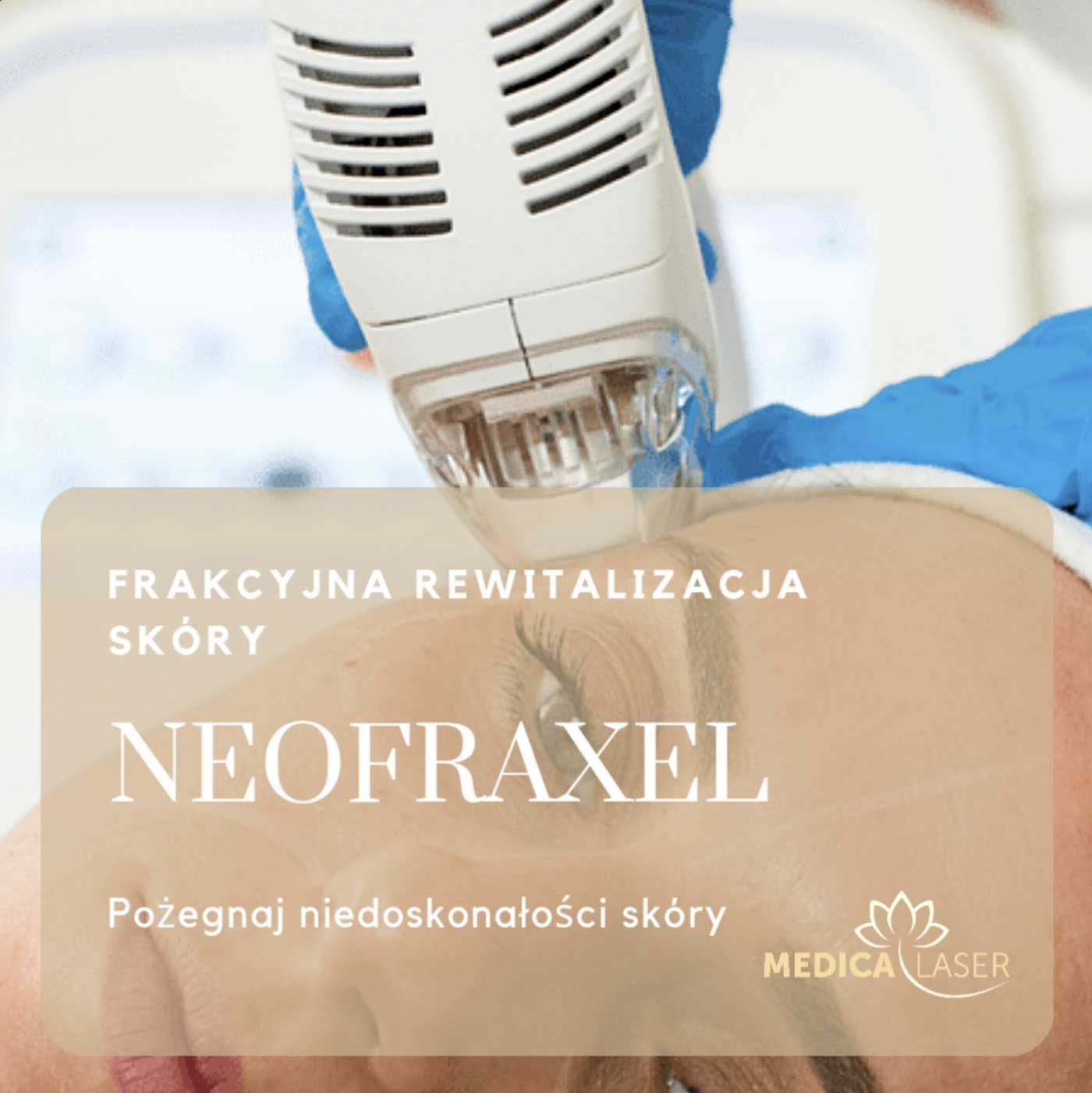 Frakcyjna rewitalizacja skóry NEOFRAXEL