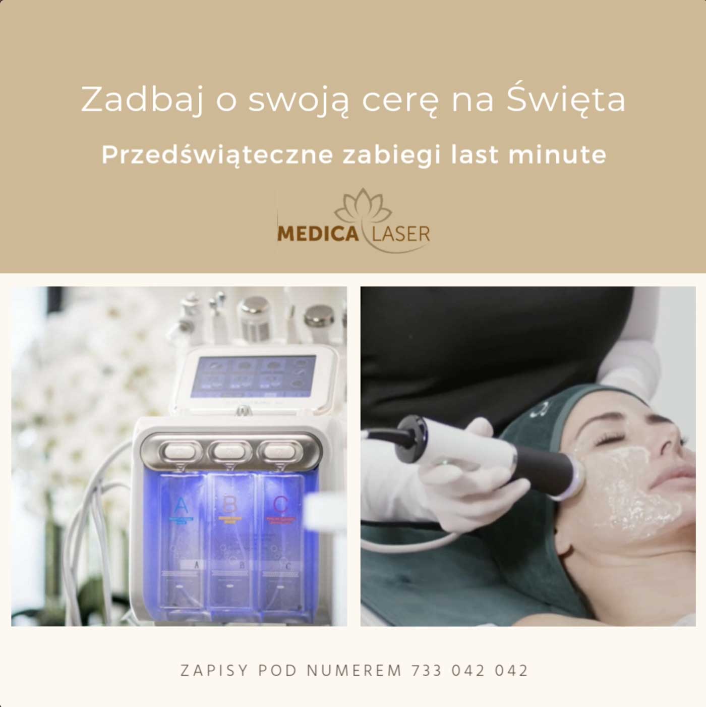 Przedświąteczne zabiegi last minute