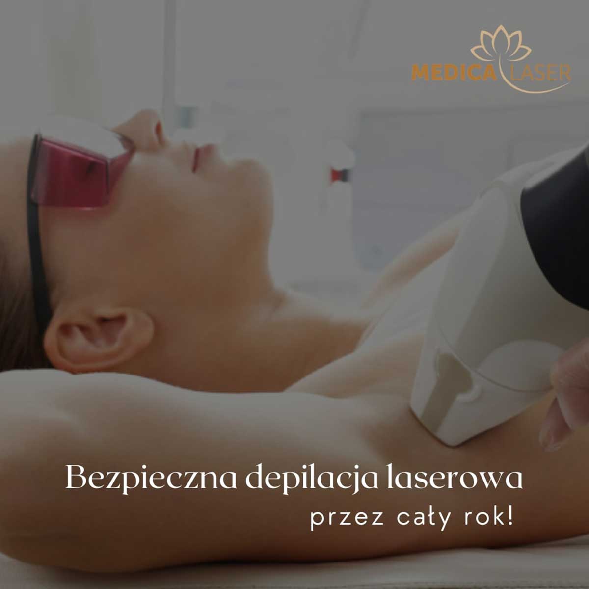 Bezpieczna depilacja laserowa przez cały rok