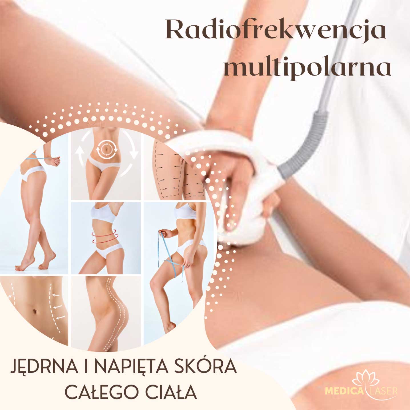 Radiofrekwencja multipolarna