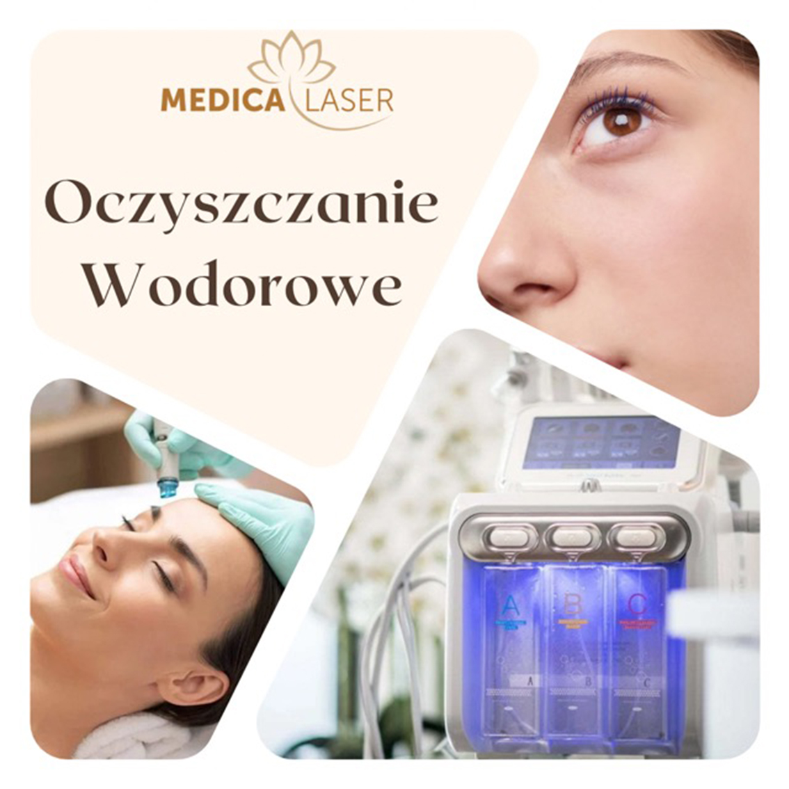 Oczyszczanie Wodorowe