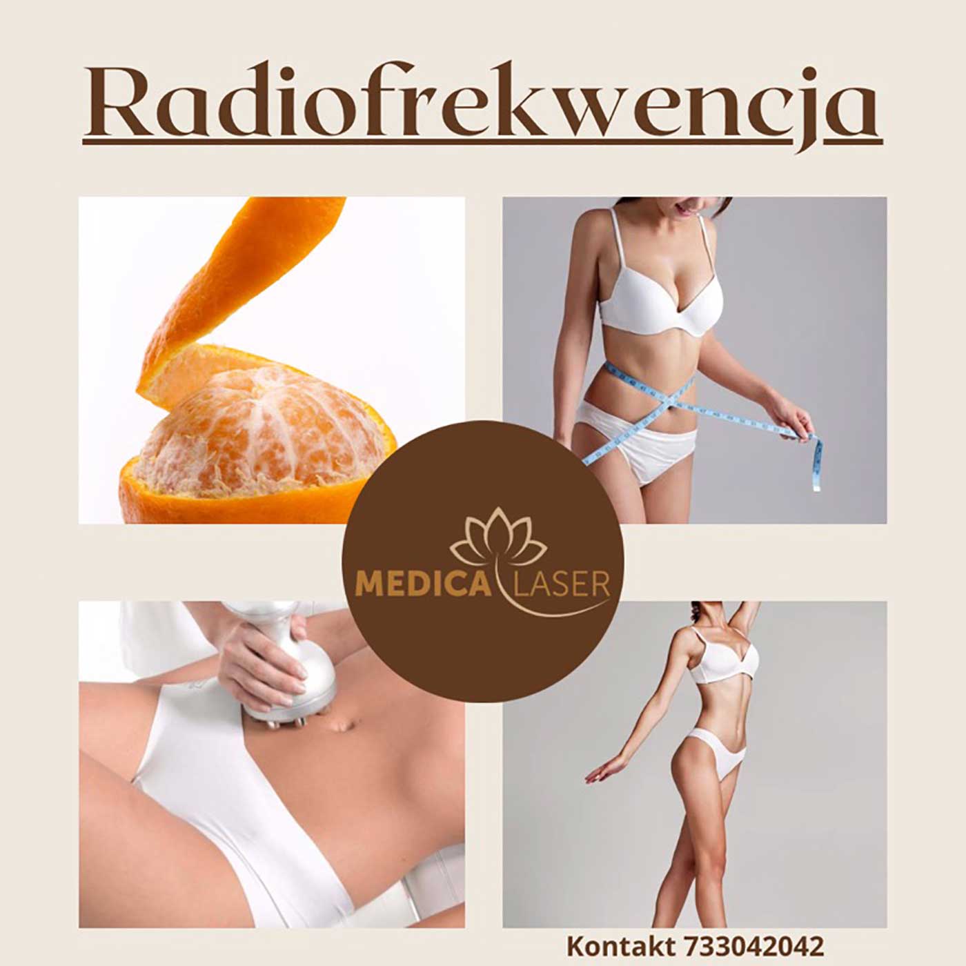 Radiofrekwencja