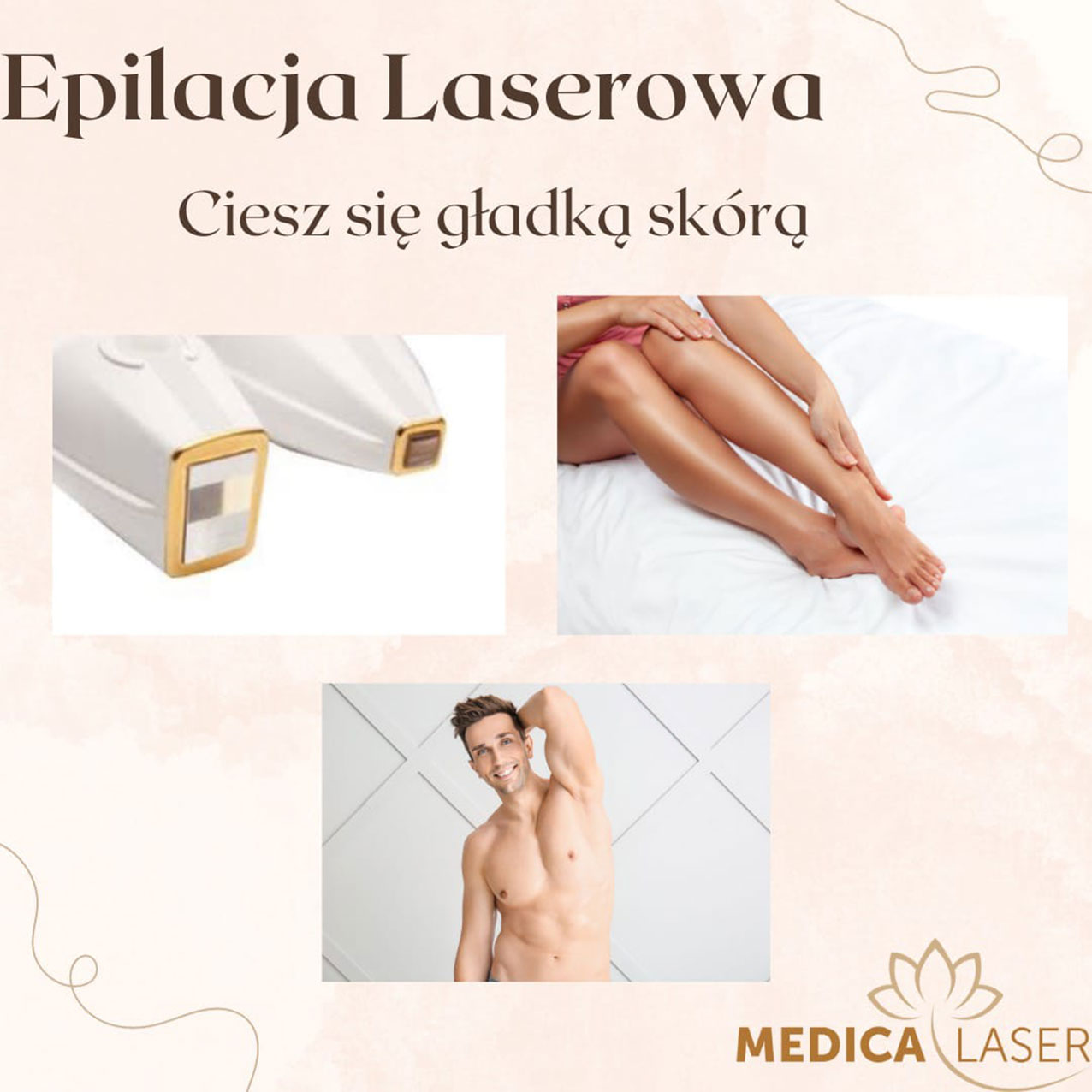 Epilacja laserowa